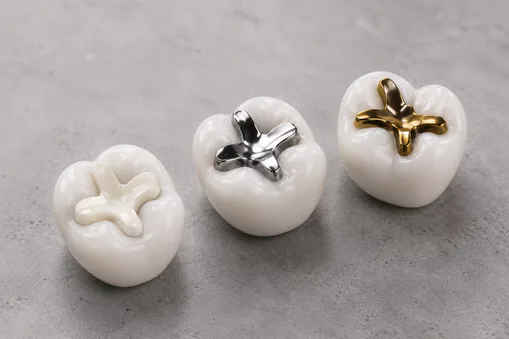 What are the different types of inlay and onlay?